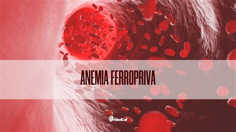 cid anemia ferropriva